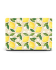 Lemon Summer Mix MacBook Case