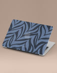 Blue Zebra MacBook Case