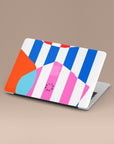 Stripped Symphony MacBook Case