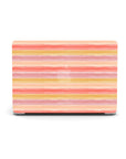 Warm Hues MacBook Case